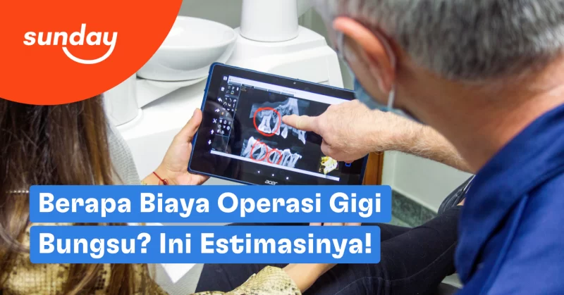 Biaya operasi gigi bungsu berkisar antara Rp1 jutaan sampai Rp6 jutaan per gigi.